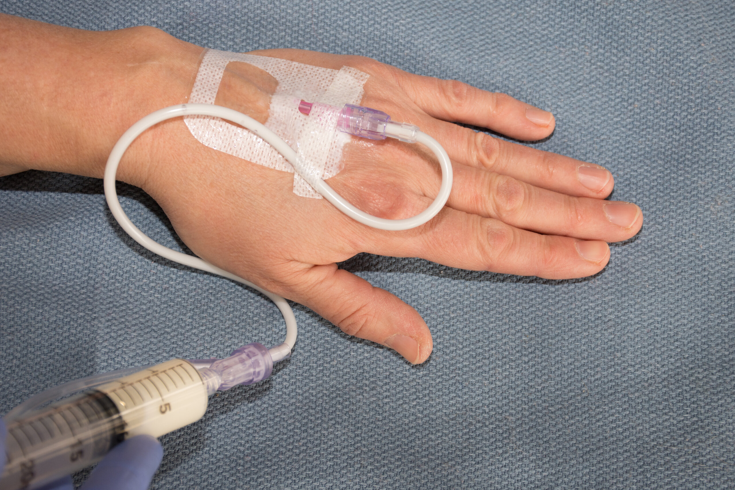 image of IV in hand